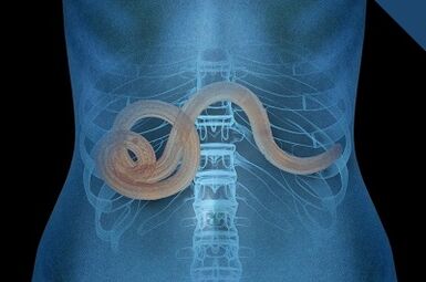 Parasites dans le corps humain