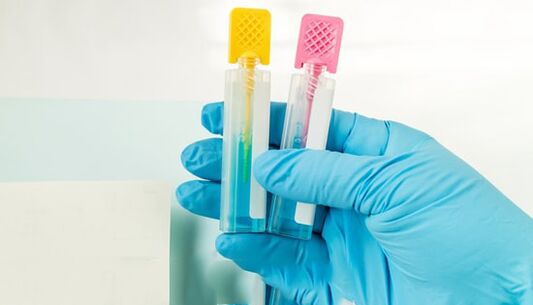 Méthodes de diagnostic parasit
