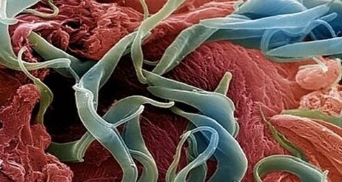 Photo de parasites dans le corps humain
